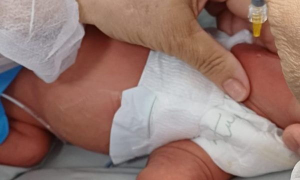 Hospitais estaduais oferecem proteção contra bronquiolite a bebês prematuros