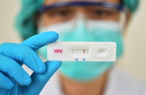SES-MT alerta sobre importância da testagem rápida contra o HIV