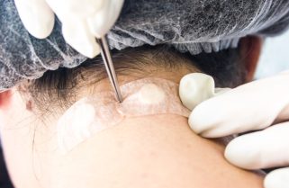 Fisioterapeuta de Cuiabá explica: Silício potencializa microfisioterapia com técnica ortomolecular