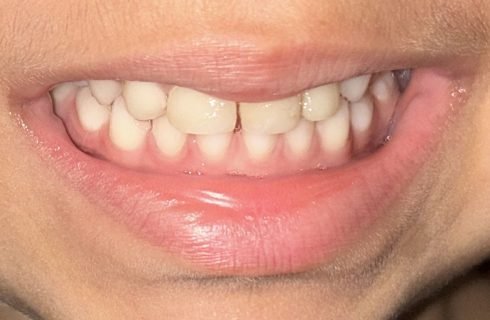 Dia Nacional da Saúde Bucal : especialista dá dicas de cuidados simples no dia a dia para ter um sorriso saudável