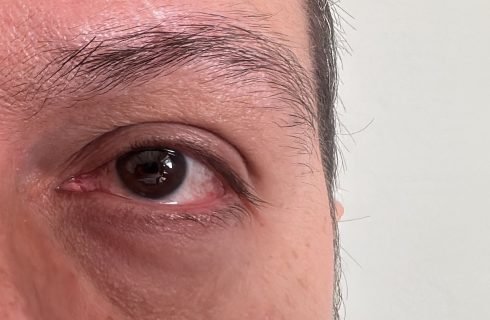 Metade da população mundial será afetada pela miopia até 2050, aponta estudo