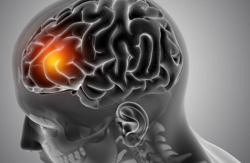 Leucemia Mieloide Aguda: uma luta contra o tempo