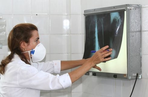Quando um nódulo nos rins é preocupante? 6 fatos sobre o câncer renal